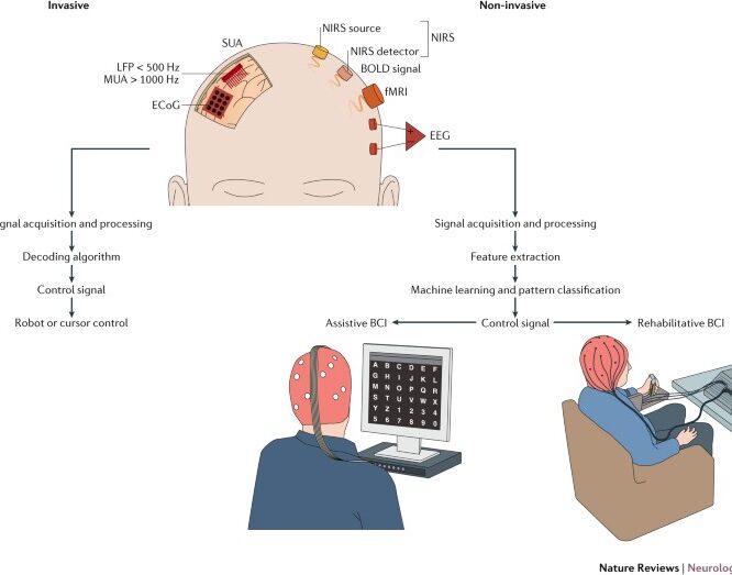 A Study Shows A Non Invasive One Size Fits All Brain Computer Interface Solution Psychology Today