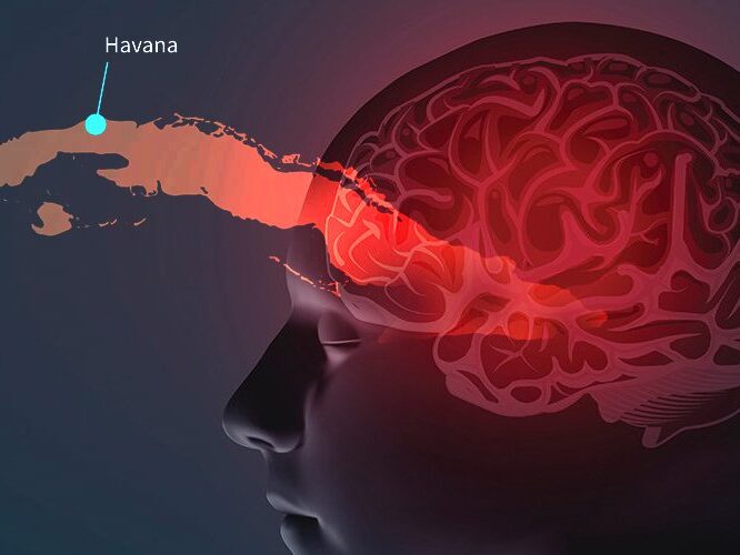 Despite symptoms nih research finds no evidence of havana syndrome in brain scans cnn