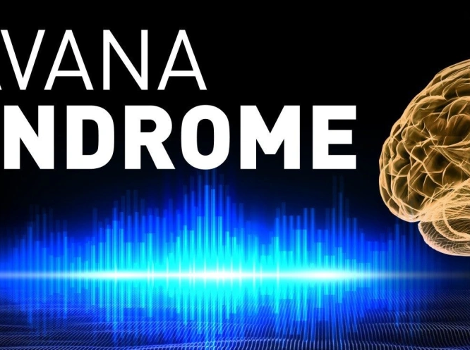 Havana Syndrome We Dont Need To Choose Between Brain Injury And Mass Hysteria Scientific American