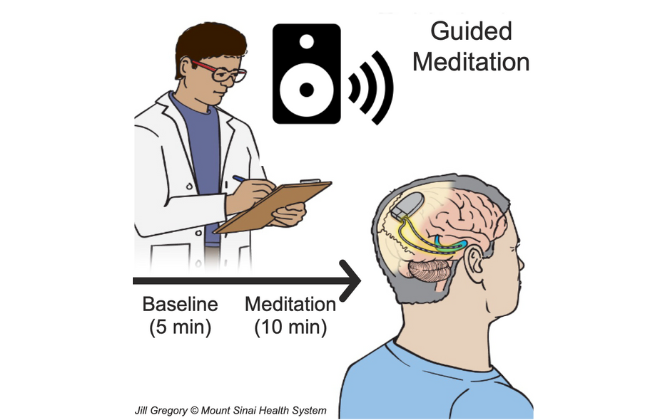 Mount Sinai Launches First Study On High Resolution Brain Computer Interface News Medical Net