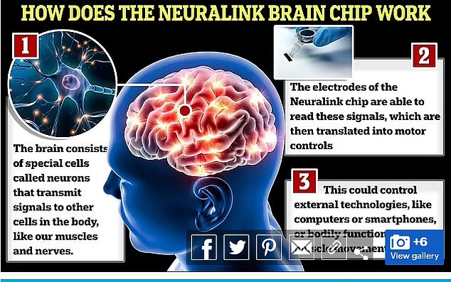 Neuralink Brain Implant Test Suffers Technical Issues Yahoo News Canada