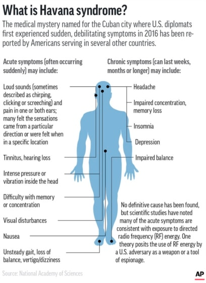 What Is Havana Syndrome Report Suggests Russia Behind Anomalous Health Incidents Times Now