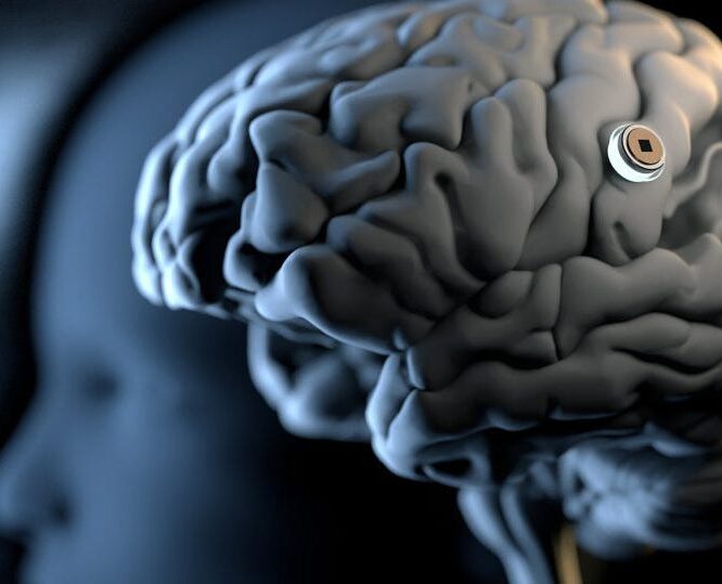 Will Brain Chip Implants Enable Thought Police By Avi Loeb Feb 2024 Medium Medium